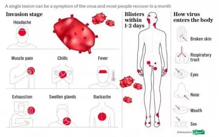 آنچه باید درباره ویروس Mpox 