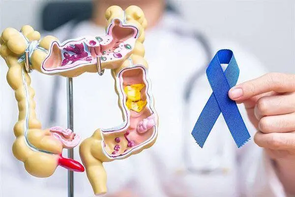 یافته‌های جدید درباره پیشگیری از